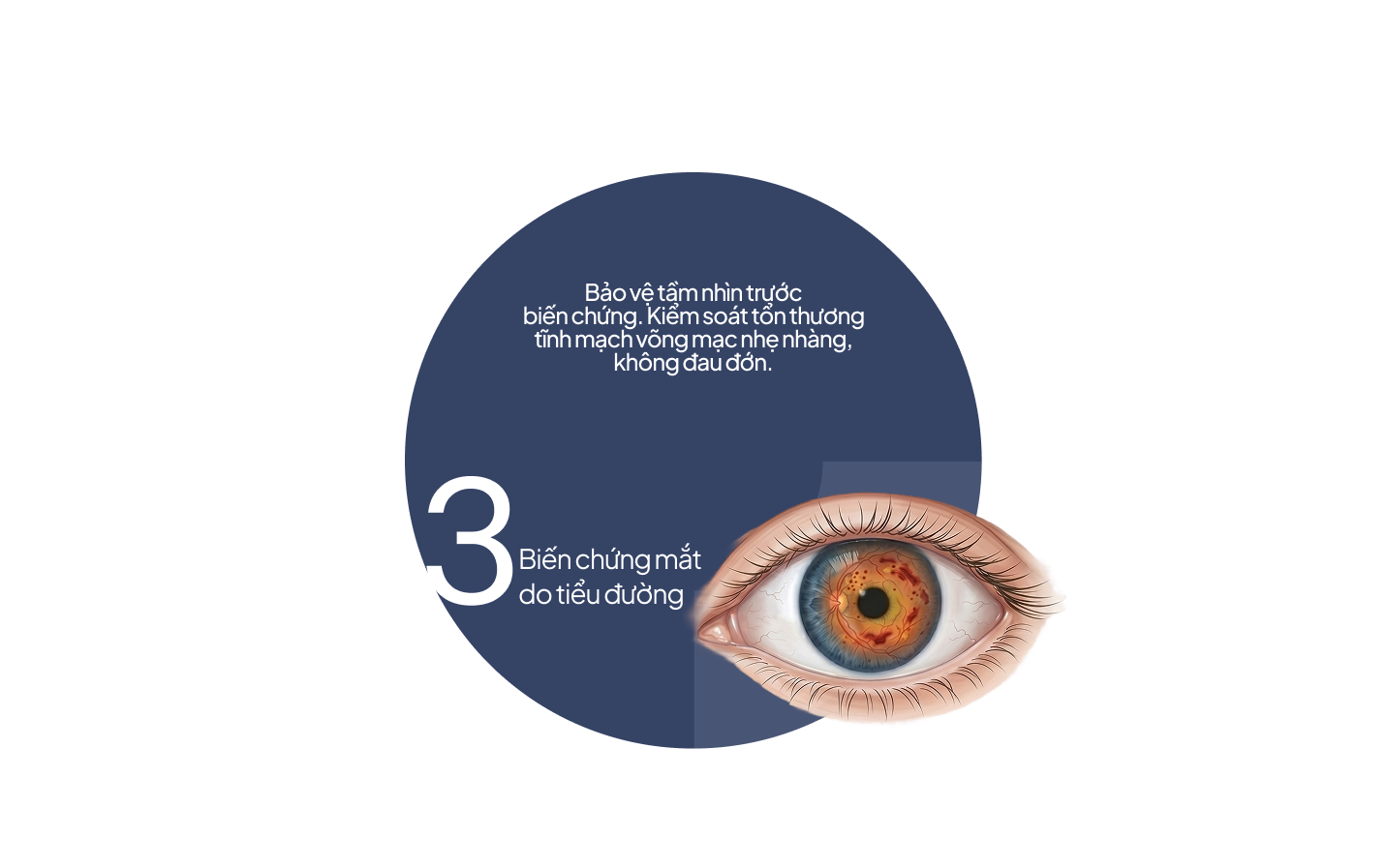 Biến chứng mắt do tiểu đường